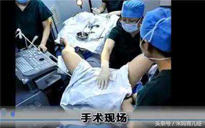 香港验血鉴别胎儿性别价格,试管婴儿全过程（图解），看哭了，真的心疼天下