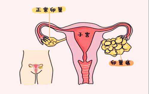 香港邮寄验血鉴定男女条件,不知不觉就怀不上了？附最全男女不孕不育排查方