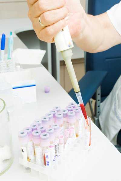 香港化验所验血价格多少_香港威望验血组织有哪几间?亲身经验给我们