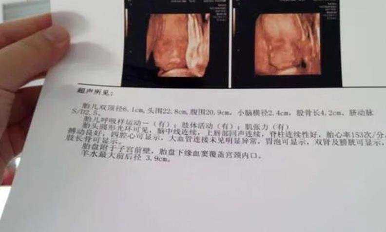 香港验血没怀孕能验男女吗_香港时代检血报告准吗_香港查男女真会翻盘吗